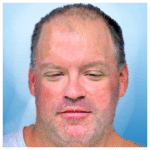 Man attacks police trying to get him to protective custody